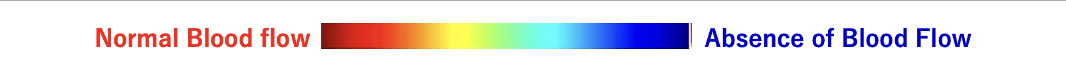 Multispectral colour scale from normal blood flow to absence of blood flow