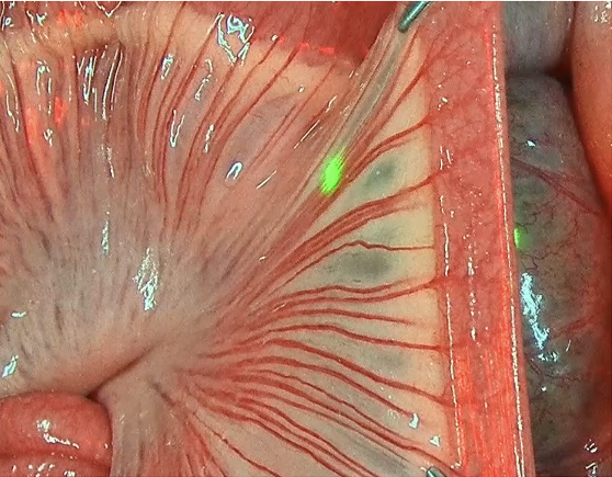 White-light surgical view of blood vessels